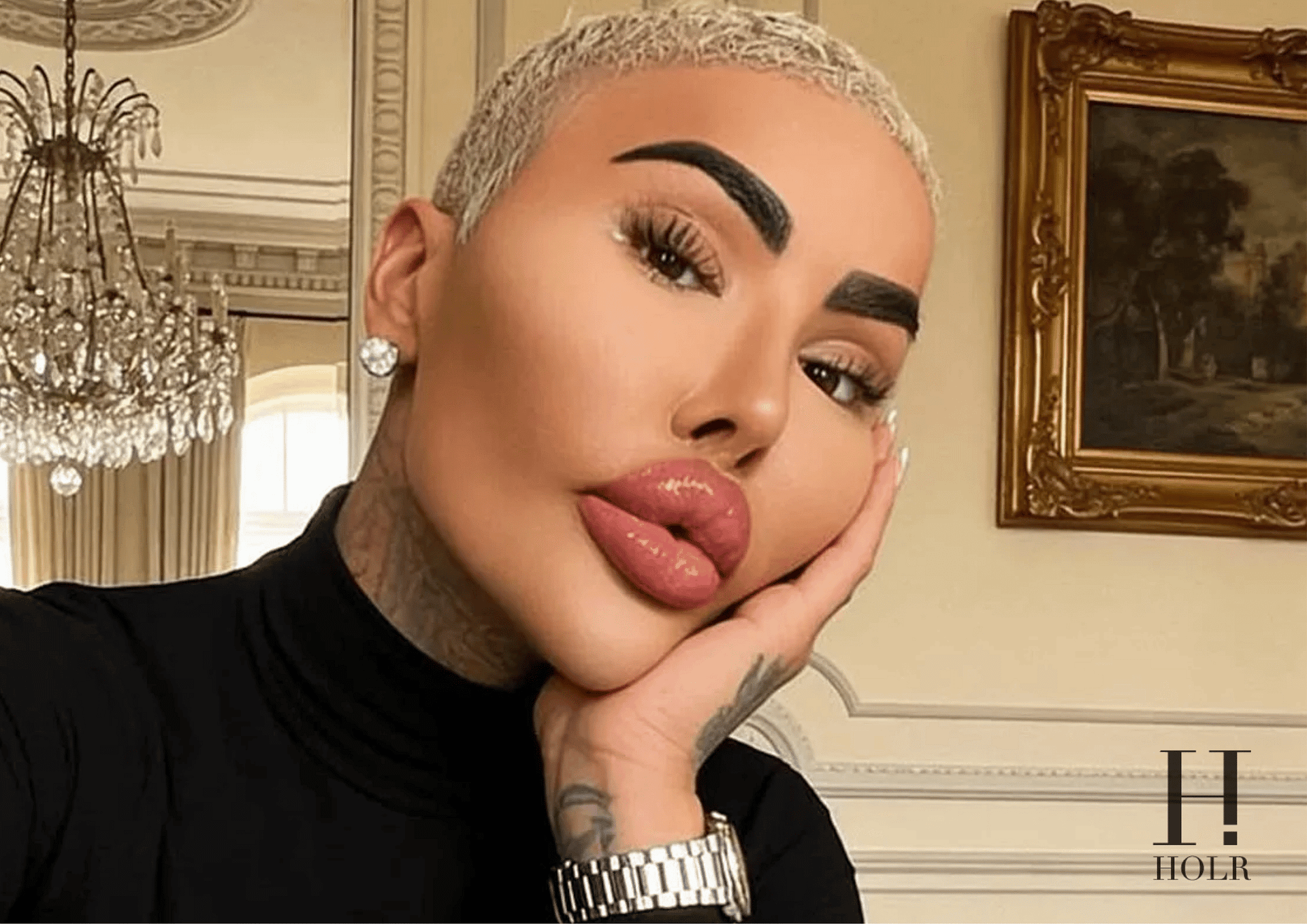 Jordan James Parke Dies After Reported Cosmetic Procedure –