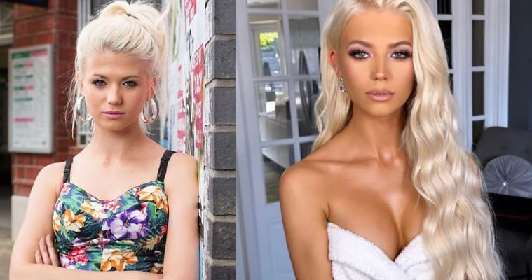 Danielle Harold Boob Job