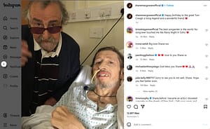 shane macgowan health