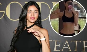 Holly Scarfone Before And After