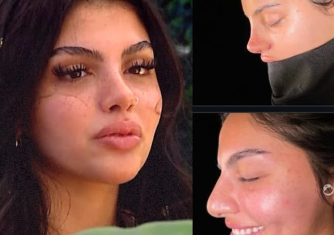 Huda Love Island Before Nose Job Photo Exposed