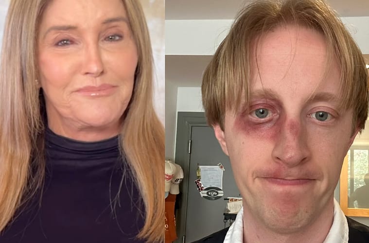 Did Caitlyn Jenner Punch Dan Carney Comedian?