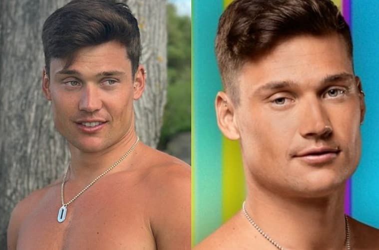 Is Aaron Love Island Gay?