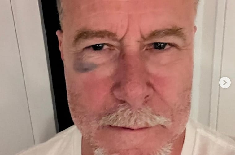 Dean McDermott Celebrates One Year Sober