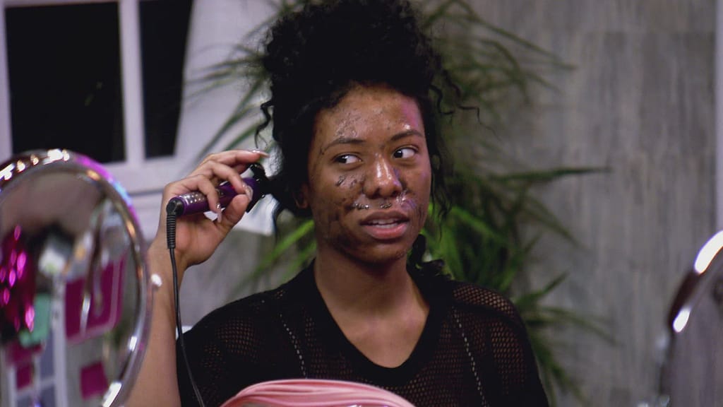 Clermont Twins Before surgery