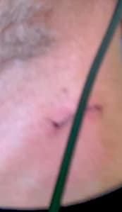 Dave Portnoy Diagnosed with Cancer? Details Revealed