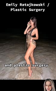 Emily Ratajkowski Plastic Surgery
