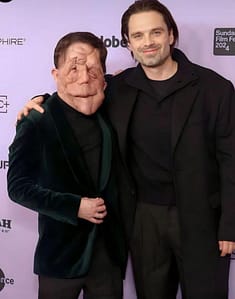 Sebastian Stan Defends Co-Star Adam Pearson