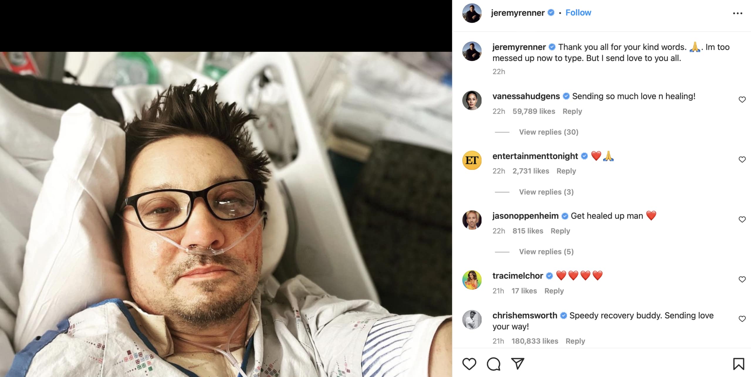 jeremy renner snow plow incident