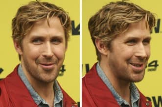 Ryan Gosling Plastic Surgery