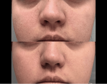 LilyAna Naturals Retinol Cream Review