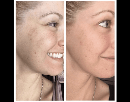 Best skincare products