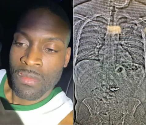 Man Charged After Swallowing $769K Worth of Tiffany & Co. Earrings in Botched Robbery