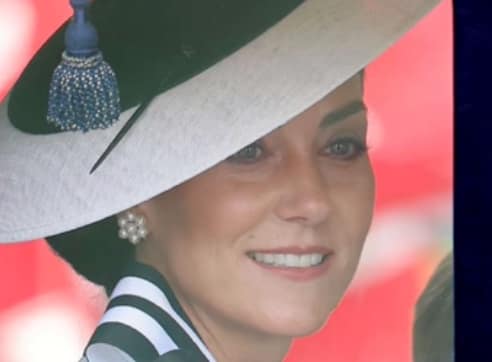 Did Kate Middleton Get A Facelift Before and After