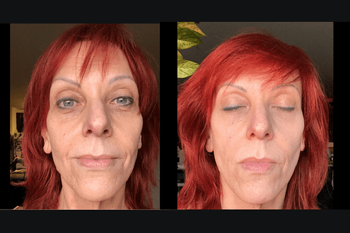 best eye cream for wrinkles