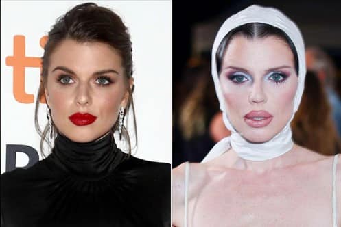 Julia Fox Regrets Cosmetic Surgeries She Did to Appeal to Men