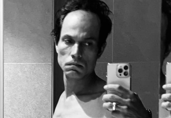 Randeep Hooda Weight Loss Photo Viral