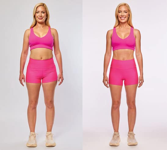 Heidi Montag Before and After