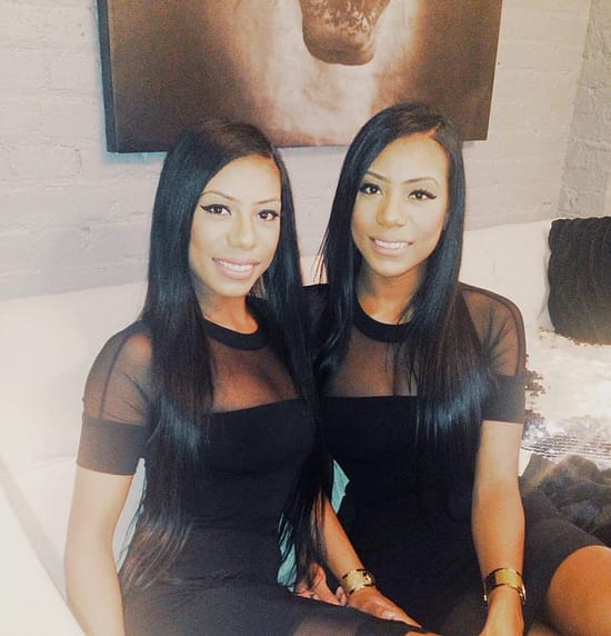 Clermont twins before and after surgery