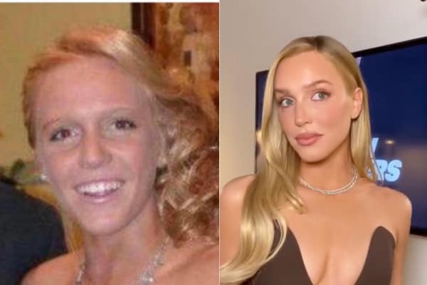 Alex Cooper Before Call Her Daddy