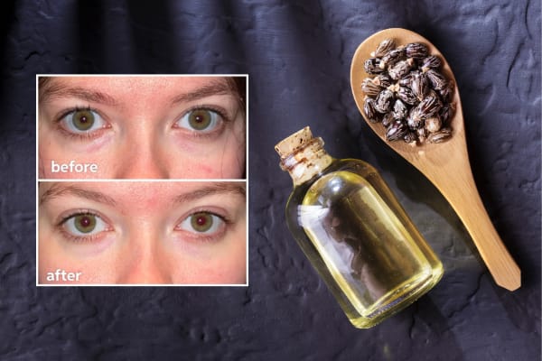 Castor Oil and Frankincense Resin Oil for Skin