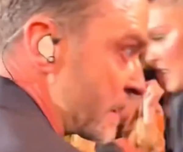 Justin Timberlake Eyes Is He Okay?