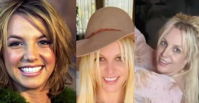 Britney Spears Teeth Before and After