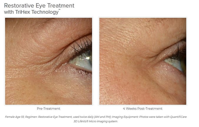 Alastin Skincare Canada