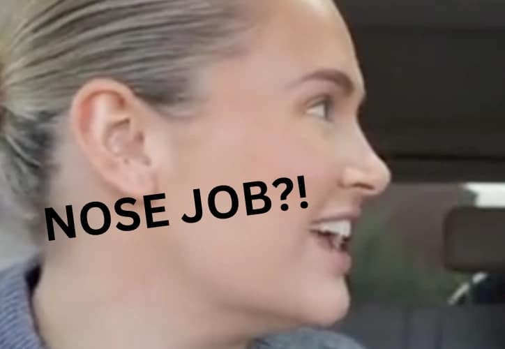 Molly Mae Nose Job Addressed