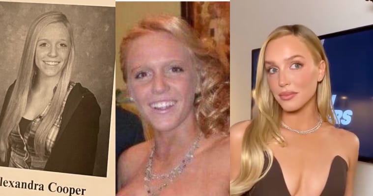 Alex Cooper Before and After