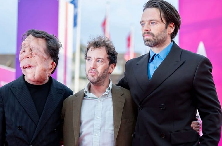 Sebastian Stan Defends Co-Star Adam Pearson