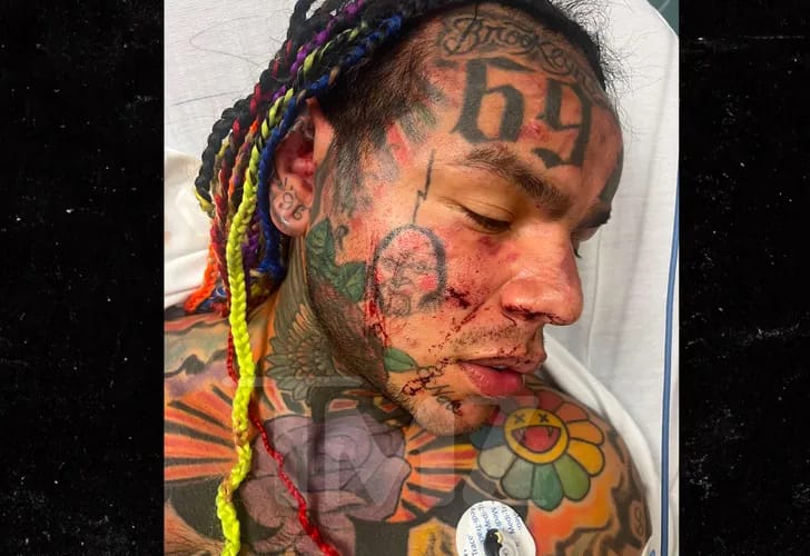 Tekashi 69 beaten up