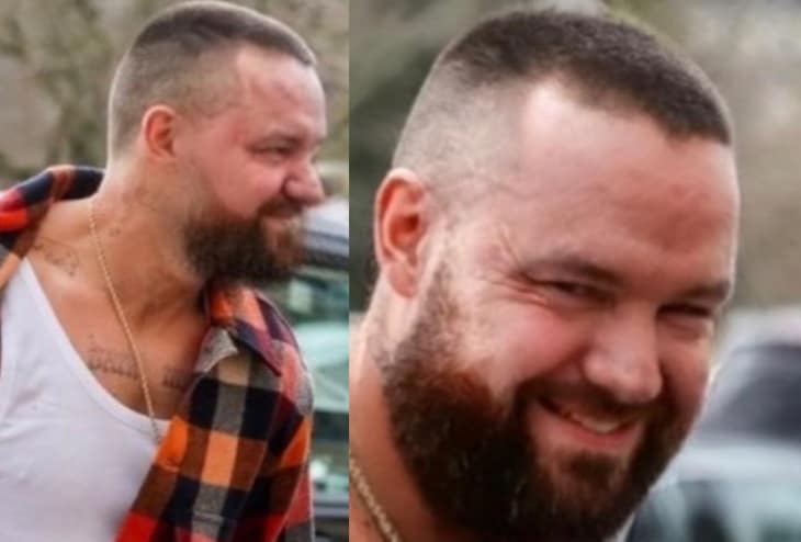 Liam Payne Swollen Weight Gain Photoshop Fail?